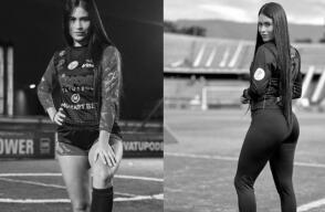 Falleció Liss Hernández, modelo de Divas del Fútbol que sufrió quemaduras por chimenea en Envigado