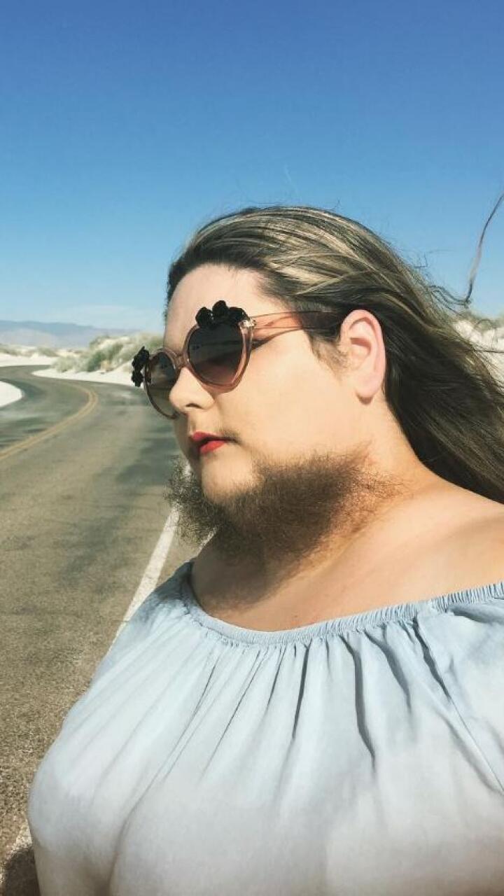 Mujer comparte su historia de amor propio tras aceptar el crecimiento de vello en su rostro
