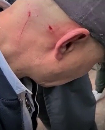 La reina del flow 2 heridas que sufrió Lucho Velasco en escena en la que muere Manín