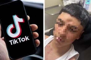 Un peligroso reto de TikTok deja a un niño con una fractura de cráneo