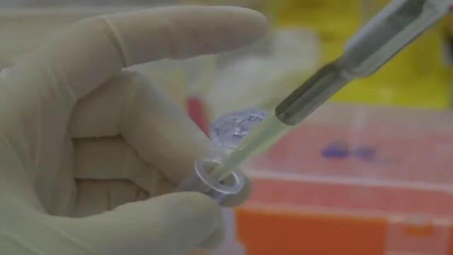 Terapias génicas y medicamentos para la esclerosis múltiple, entre las noticias de la salud en 2017
