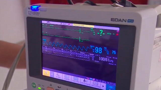 Cómo saber si está sufriendo un ataque cerebrovascular