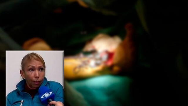 Lo barato sale caro: casi muere por creer que un peluquero podía agrandarle los glúteos