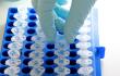 Brote bacteriano de E. coli ya deja un muerto y 15 hospitalizados en EE. UU.