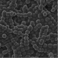 Streptococcus agalactiae: la bacteria que está matando peces de cultivo en Colombia