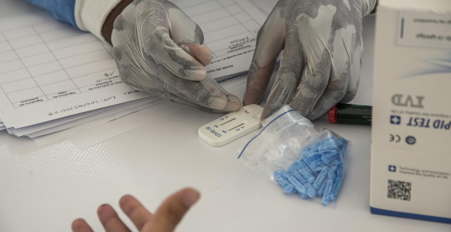 359340_Test coronavirus. Foto: AFP