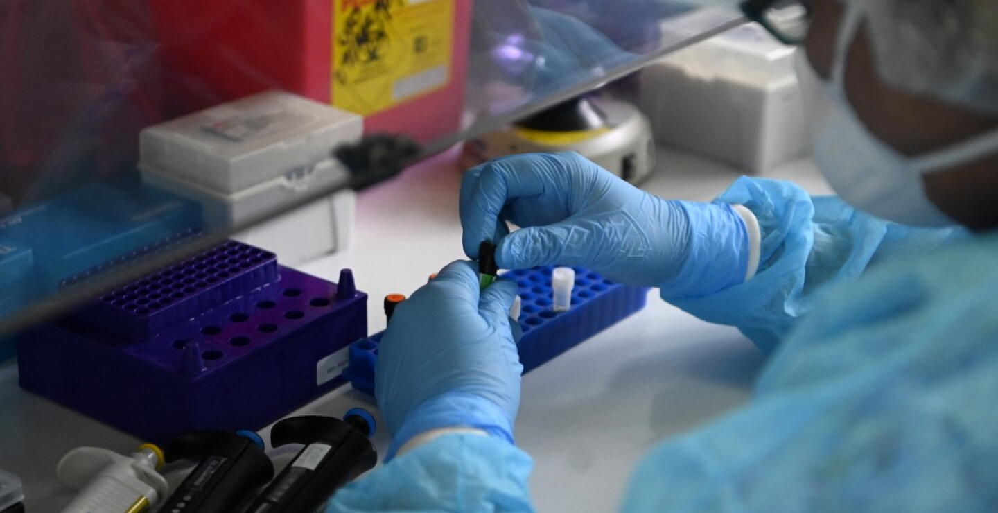 370674_Test coronavirus. Foto: AFP