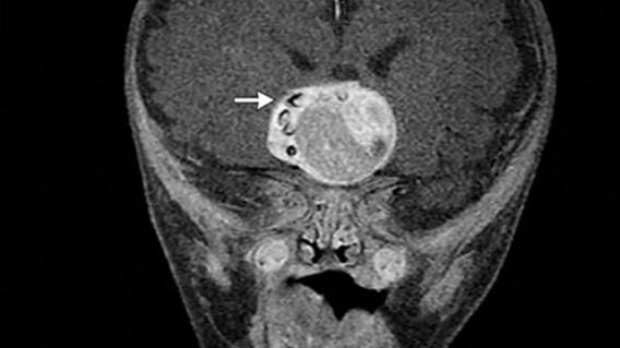 Foto: New England Journal of Medicine