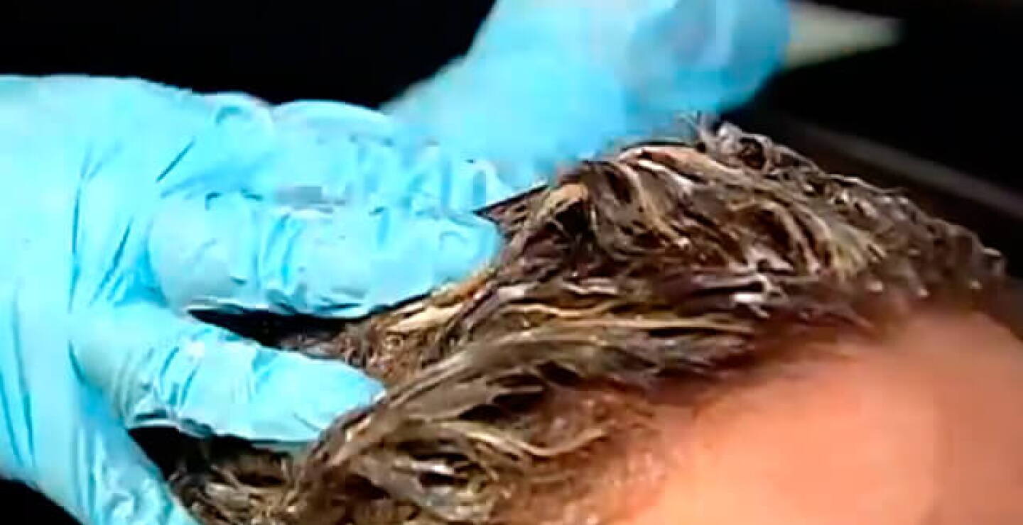 caida-del-pelo.jpg