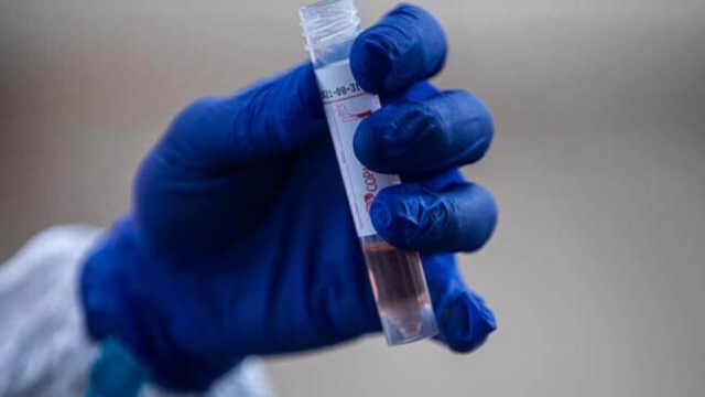 Israel asegura que logró desarrollar un anticuerpo para neutralizar el coronavirus