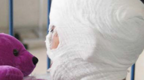 284823_Blu Radio / Quemados. Foto: Referencia AFP.