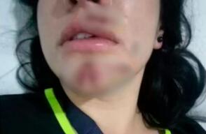 acosocalle.jpg
