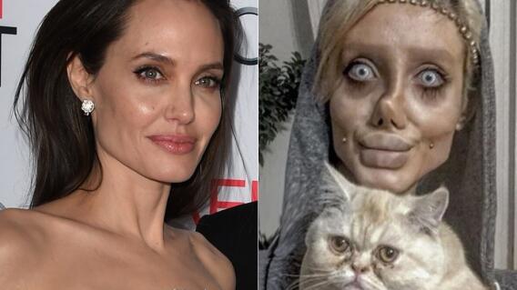 6712_La Kalle - Se hizo más de 50 cirugías para parecerse a Angelina Jolie - Fotos AFP e Instagram 6712_La Kalle - Se hizo más de 50 cirugías para parecerse a Angelina Jolie - Fotos AFP e Instagram