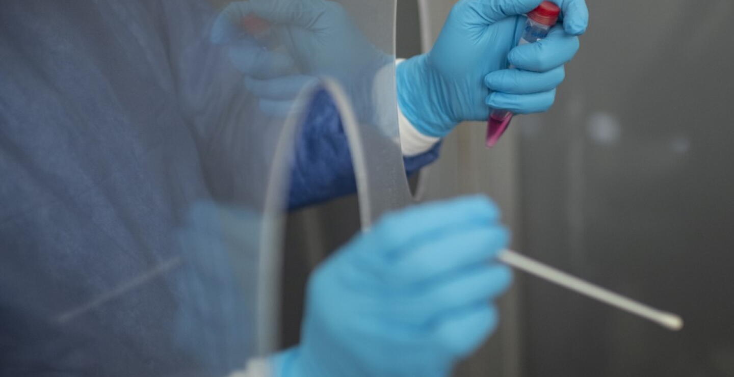 371645_Test coronavirus. Foto: AFP