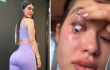 Modelo bogotana es agredida por su expareja