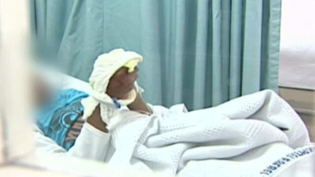 En Antioquia van dos menores de edad quemados con pólvora, uno de ellos con amputación