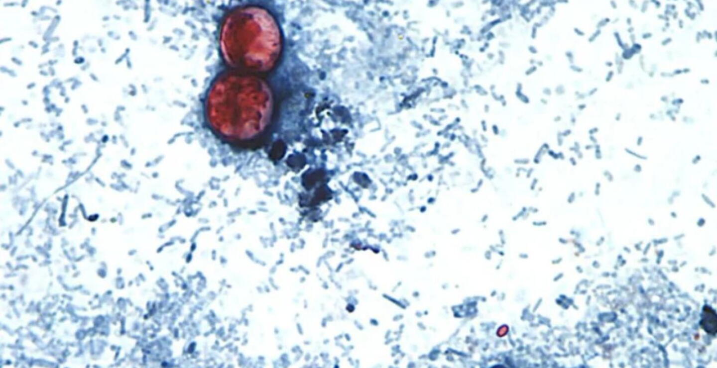 Sigue alerta por brote de ciclosporiasis: caen ventas de Taco Bell y Reino Unido identifica casos