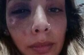 Macarena Bogado , mujer argentina víctima de maltrato por su pareja