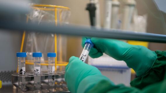 Test coronavirus. Foto: AFP Test coronavirus. Foto: AFP