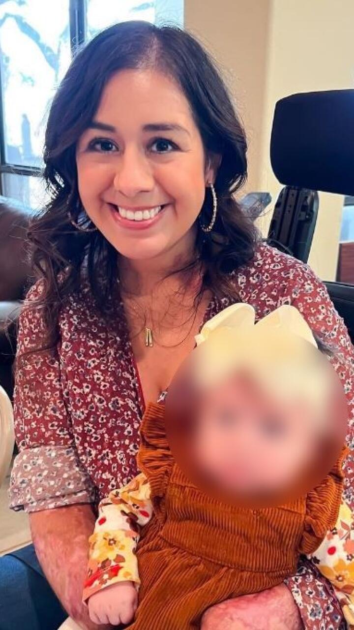 Mujer entró en choque séptico tras dar a luz y le debieron amputar manos y píes