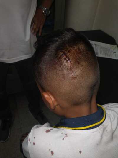 niño herido en la cabeza por caida de techo en colegio de medellin niño herido en la cabeza por caida de techo en colegio de medellin