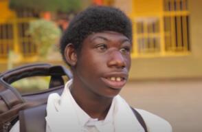 Zanziman Ellie sufrió durante años las burlas de otros por su apariencia.
 Zanziman Ellie sufrió durante años las burlas de otros por su apariencia.