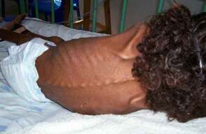desnutricion-infantil-colp.jpg desnutricion-infantil-colp.jpg