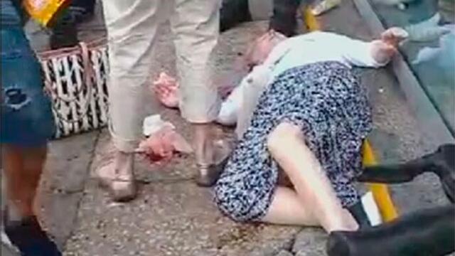 Turista de 68 años se fracturó brazo al caer en un hueco, en pleno centro histórico de Cartagena