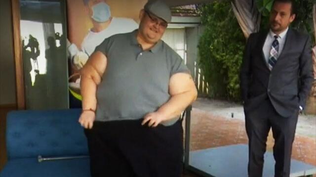 ¡Logro de mucho peso! Hombre más obeso del mundo bajó 334 kilos y se puso de pie después de 20 años