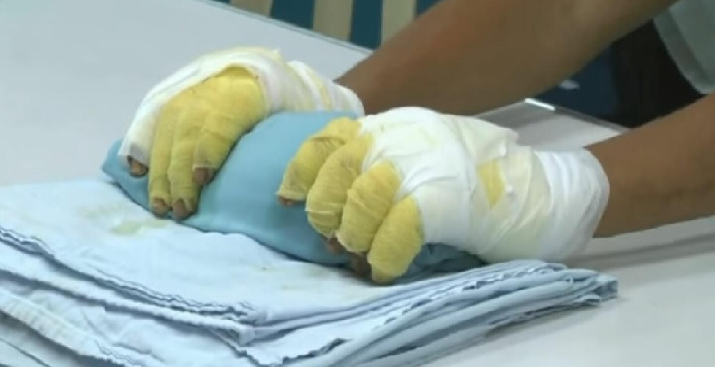 quemado1.jpg