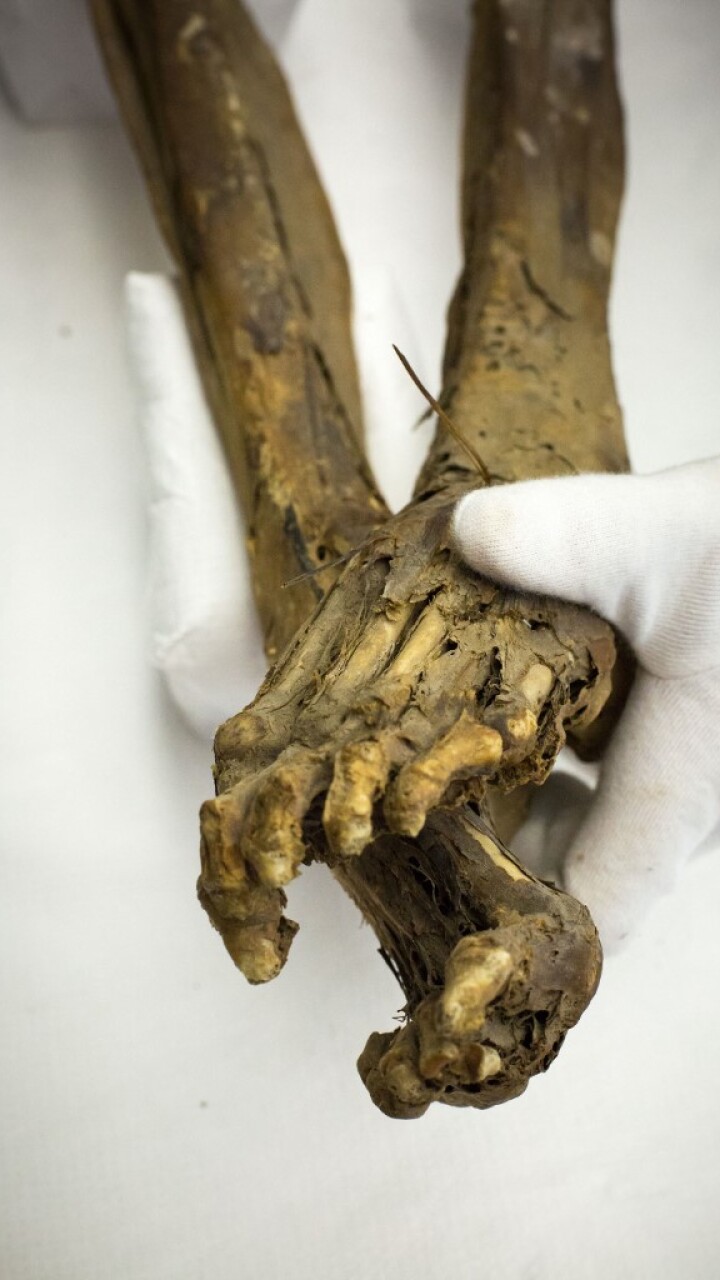 Científicos revelan la causa de muerte de la momia mejor conservada de Suiza  del siglo XVIII - BluRadio