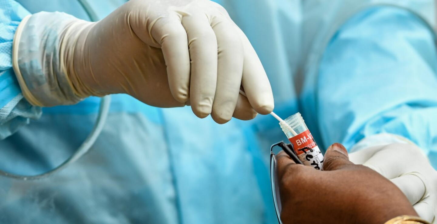 371529_Test coronavirus. Foto: AFP