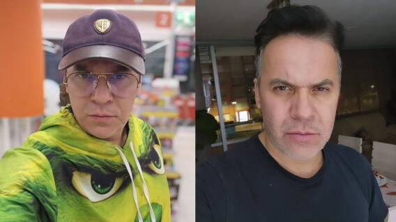 Polilla Ralph Polilla habla sobre el accidente que lo llevó a cuatro cirugías ...