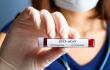 21436_Coronavirus / FOTO: Getty images