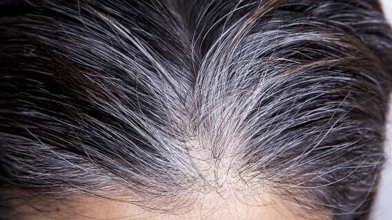 Arrancar las canas puede irritar el cuero cabelludo Arrancar las canas puede irritar el cuero cabelludo