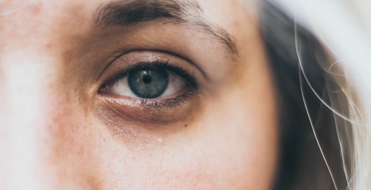 Ojeras