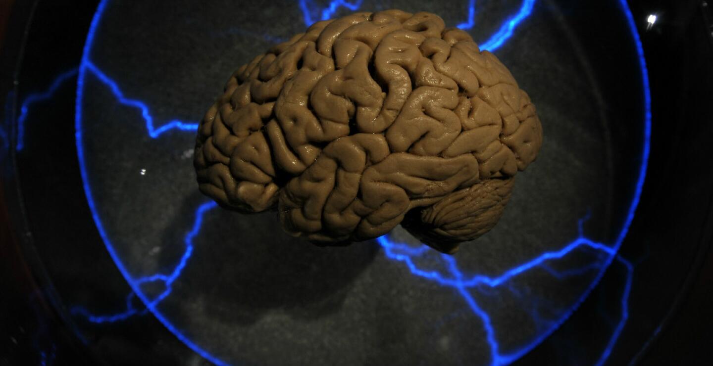 BLU Radio. Cerebro / Foto referencia: AFP