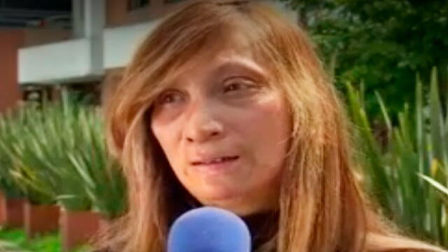 “Queda uno marcado para toda la vida”: víctima de pólvora habla de lo que ha sufrido por 32 años