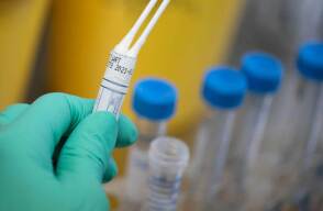 359200_BLU Radio. Laboratorio COVID-19 / Foto:Suministrada