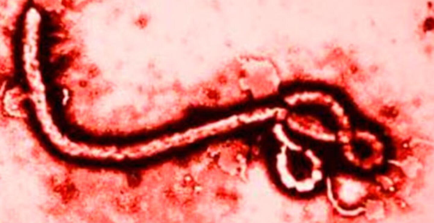 011014-ebola.jpg