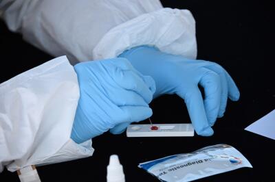 373404_Test coronavirus. Foto: AFP
