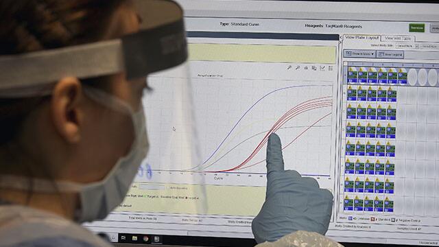 "No hemos llegado al pico en Colombia": epidemiólogo analiza curva de coronavirus 