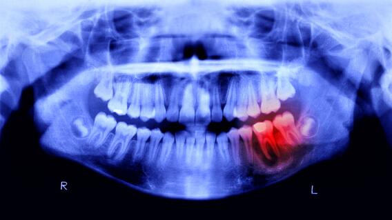 Dientes Dientes