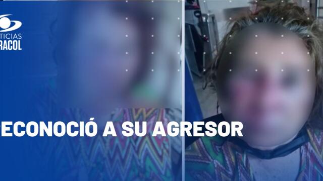 Abuelita en Floridablanca, Santander, fue víctima de golpiza por presunto ladrón Abuelita en Floridablanca, Santander, fue víctima de golpiza por presunto ladrón