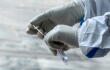 376098_Test coronavirus. Foto: AFP