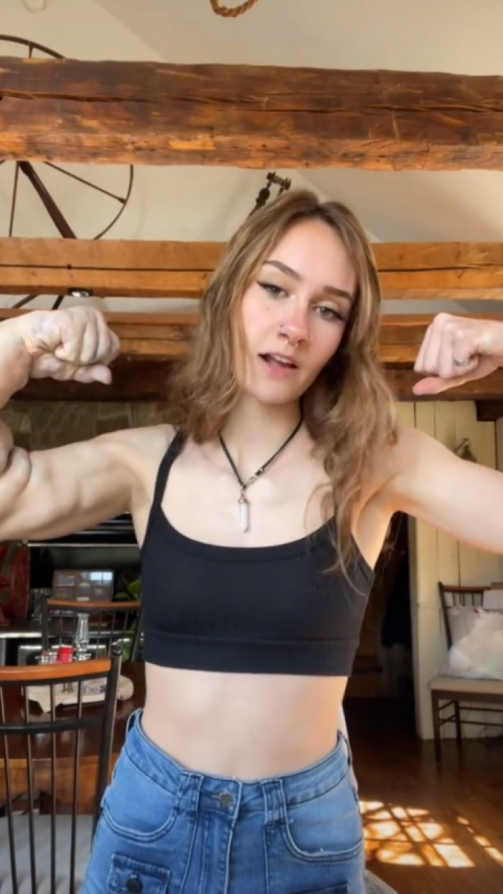 Joven que nació con malformación en su brazo asegura que internautas le aconsejan “amputárselo” 