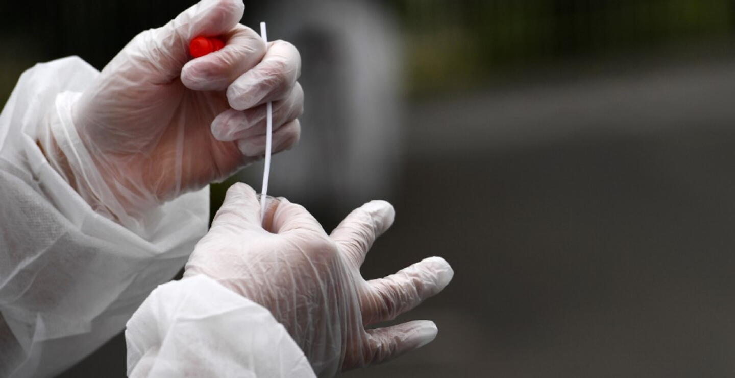 373157_Test coronavirus. Foto: AFP