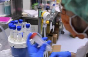 360559_Test coronavirus. Foto: AFP