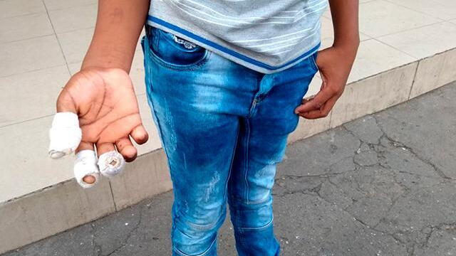 Madres de niños quemados con pólvora en Cali relataron su drama