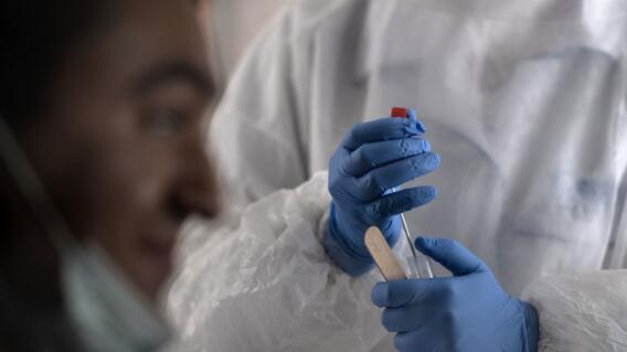 371907_Test coronavirus. Foto: AFP
